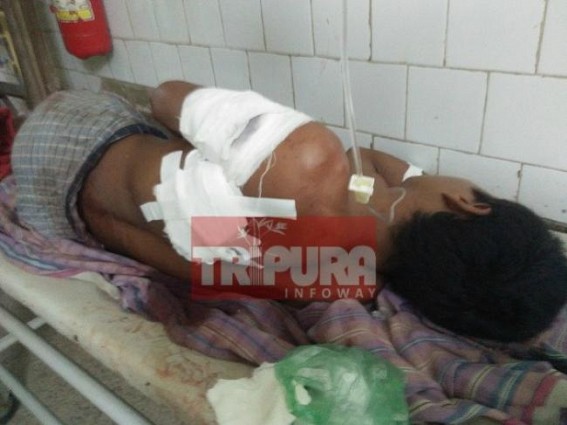 Man shot at Tripura, critical